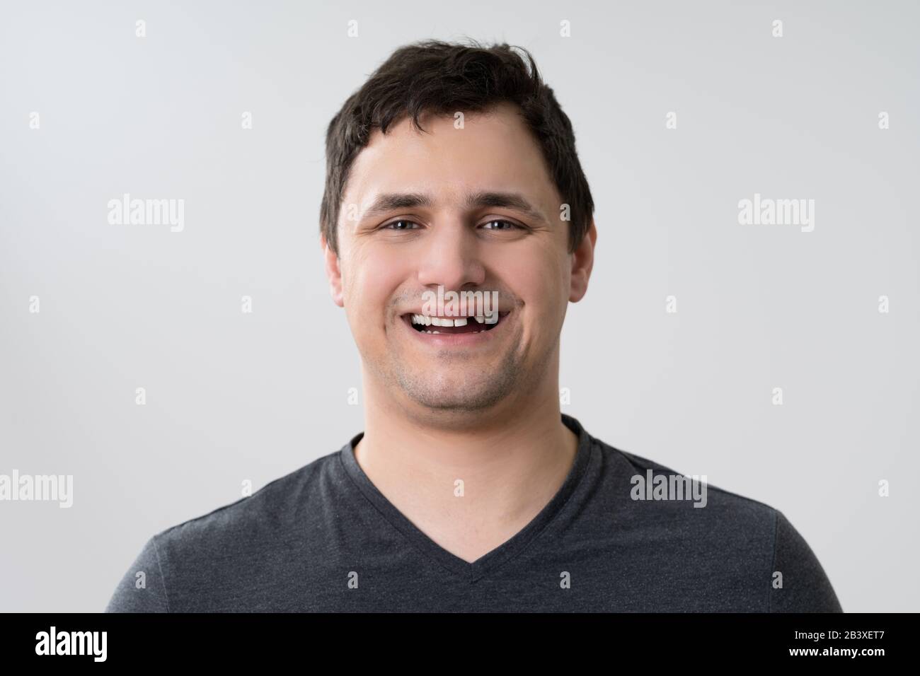 Portrait Of Young Man With Missing Tooth Stock Photo