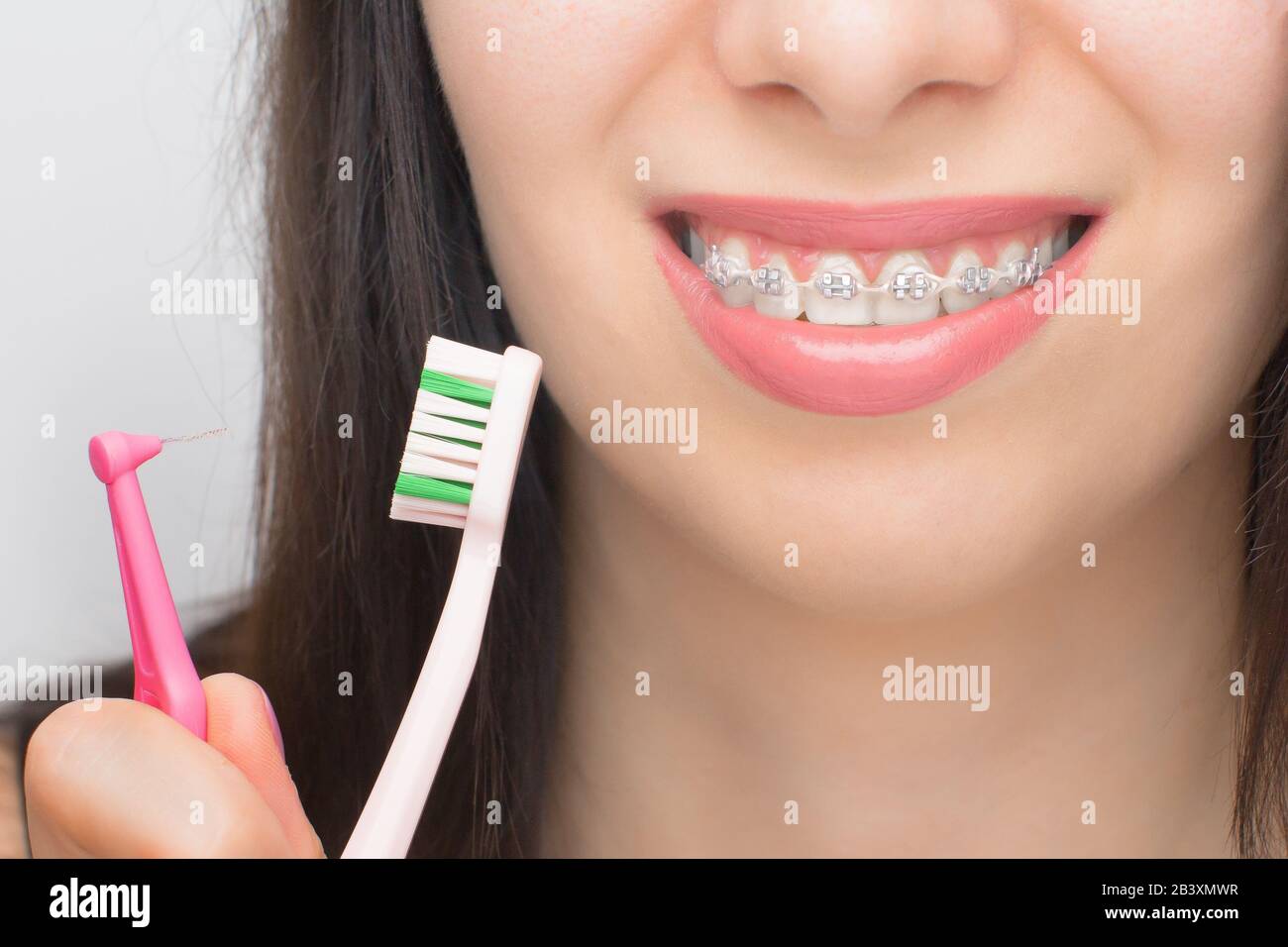Two types of brush for cleaning teeth with dental braces. Brackets on