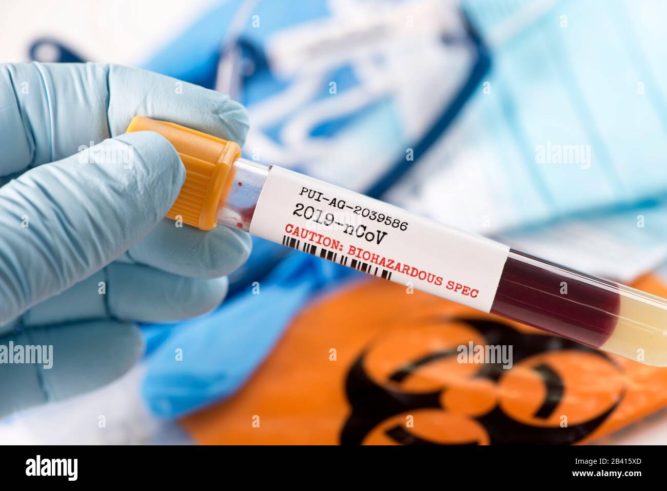 Corona virus 2019-nCoV blood test in gold top serum separator blood tube with gloves, mask and biohazard bag. Stock Photo