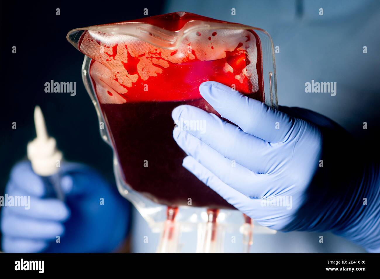 Nurse prepares donor IV blood unit for transfusion with dark background. Stock Photo