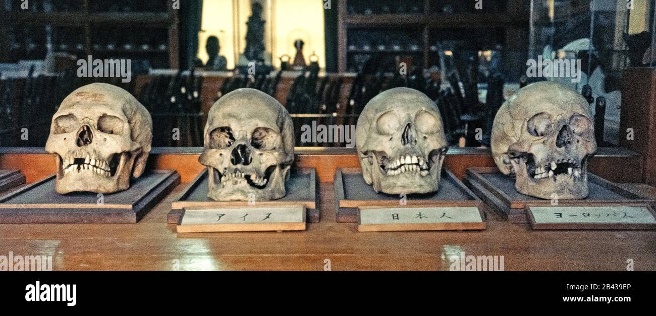 These four ancient human skulls were among thousands of relics from Japan’s Ainu aborigines that were on display at the Medical School at Hokkaido University when this historical photograph was taken in 1962 on the island of Hokkaido in northern Japan. The collection of more than 1,000 skulls has helped university professors determine the origin and background of the Ainu, who were officially recognized as indigenous people of Japan in 2008. Stock Photo