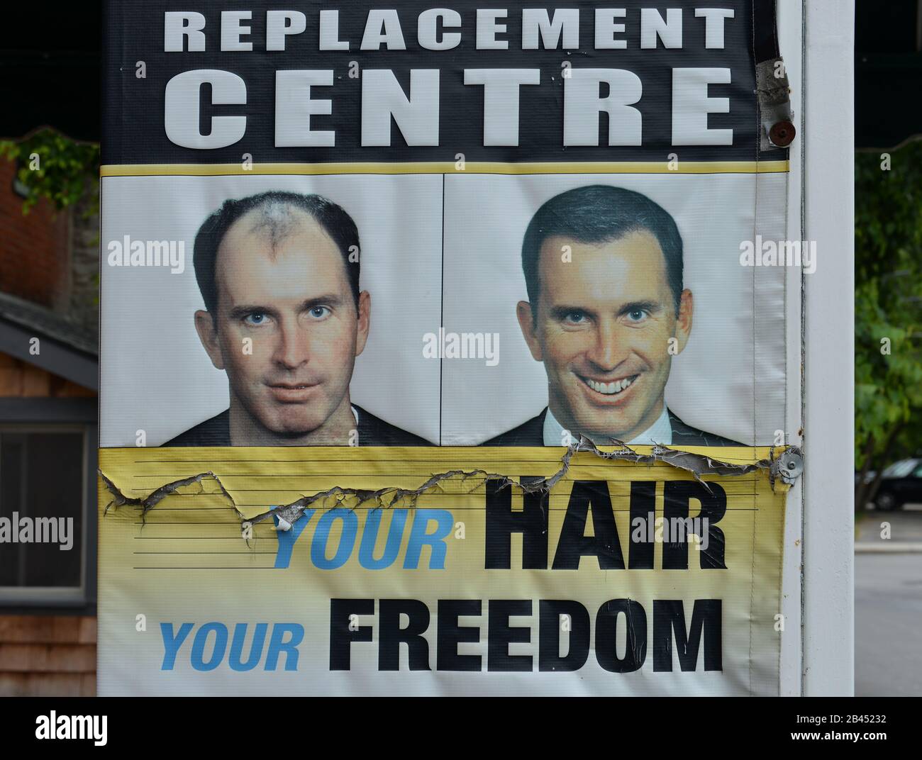 Werbung, Haartransplantation, Kingston, Ontario, Kanada Stock Photo