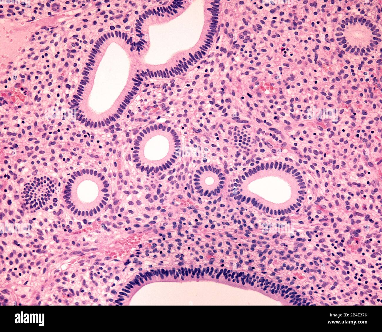 Human endometrium. Proliferative phase. Several tubular endometrial glands are cross sectioned showing their simple columnar epithelium. Among them, t Stock Photo