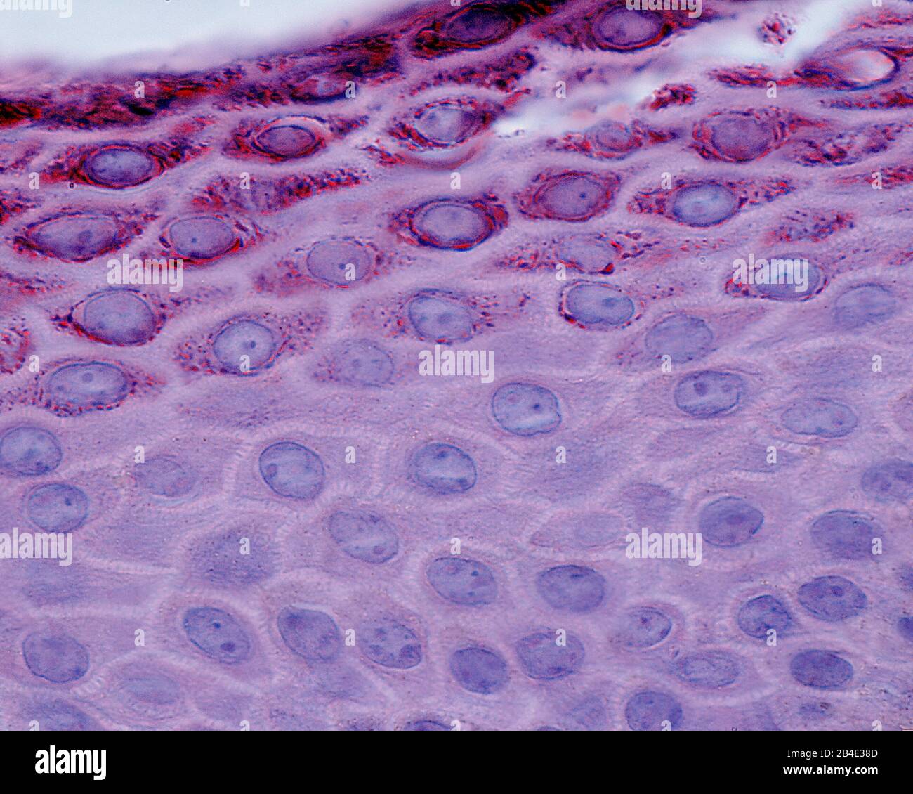 layers of epidermis histology