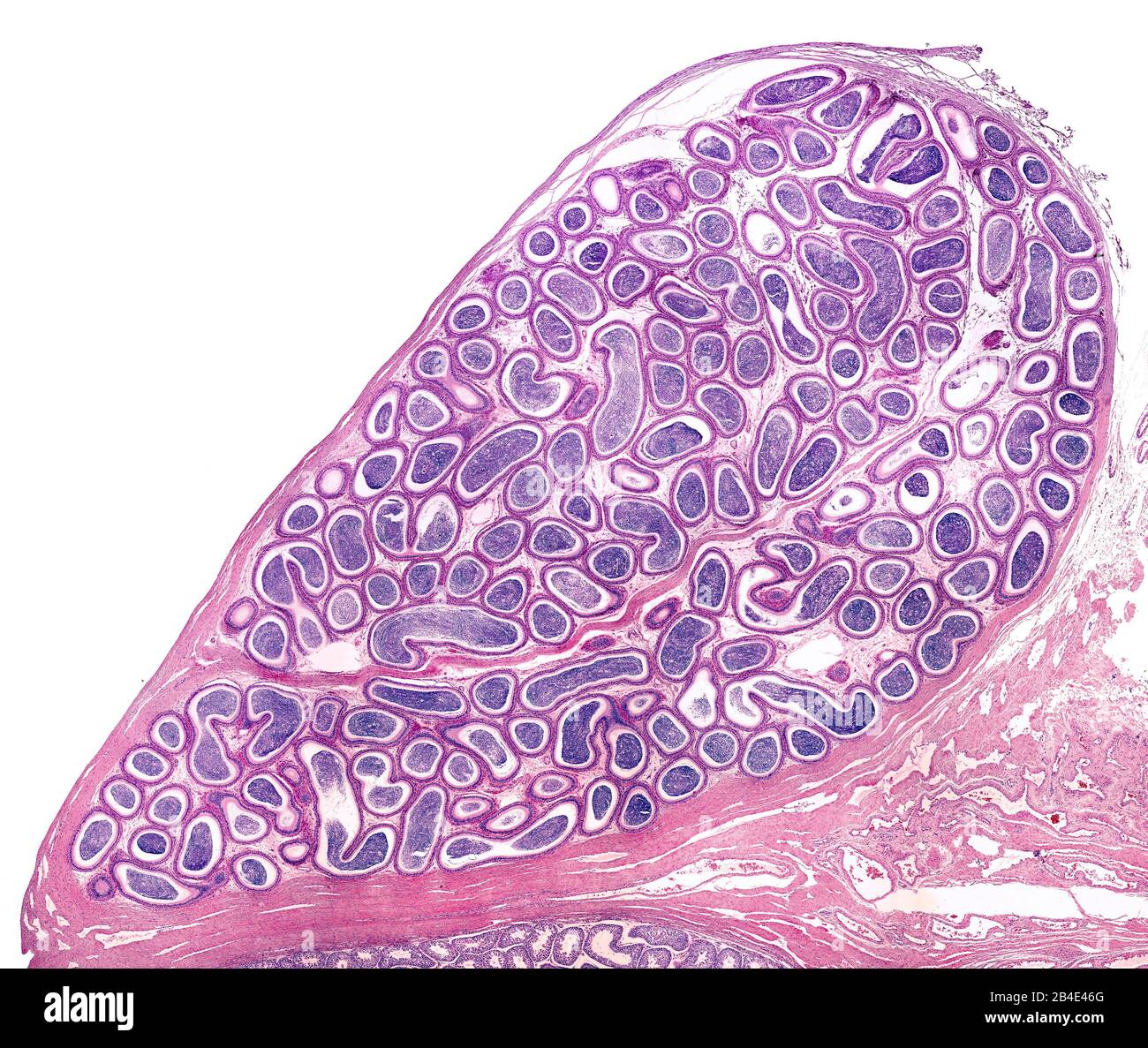 Human epididymis in their anatomical location joined to testicle (located in the bottom border of the image). The epididymal duct is a long tube very Stock Photo