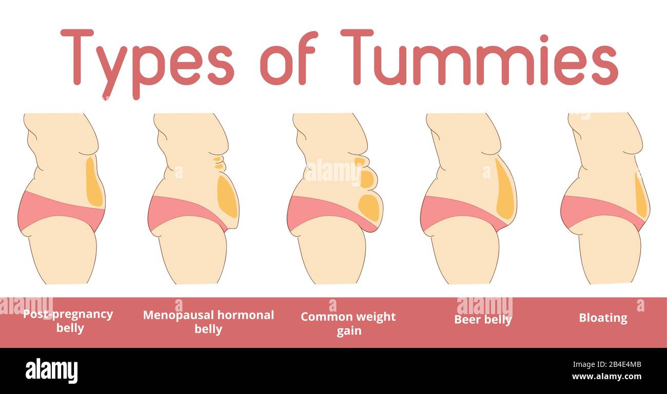 Surgery tummy Stock Vector Images Alamy