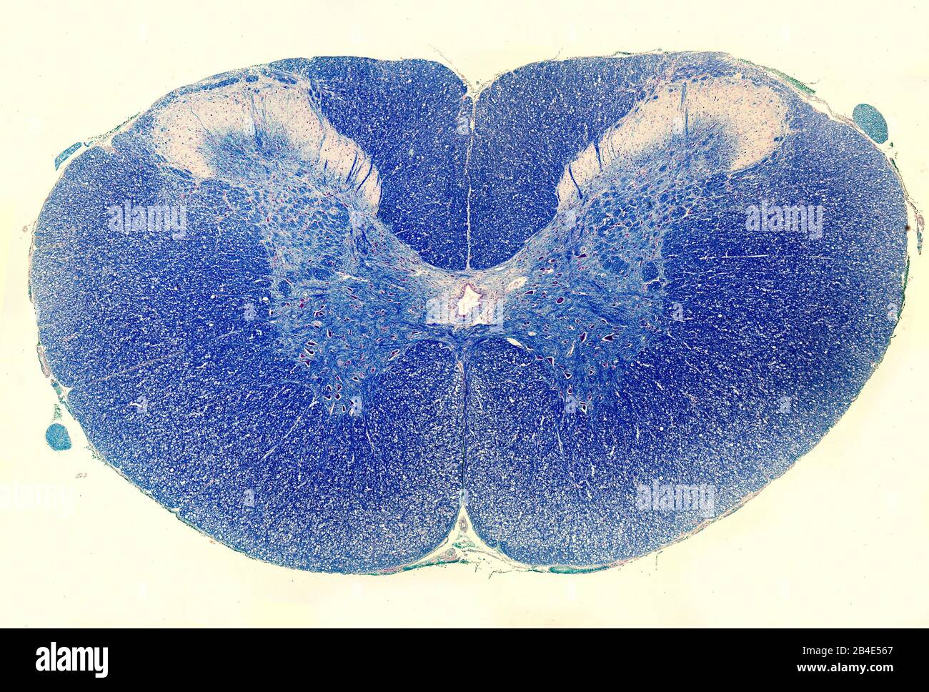 Cross sectioned spinal cord stained with Luxol Fast Blue. The grey matter is located in the centre and is surrounded by the white matter, which is sta Stock Photo