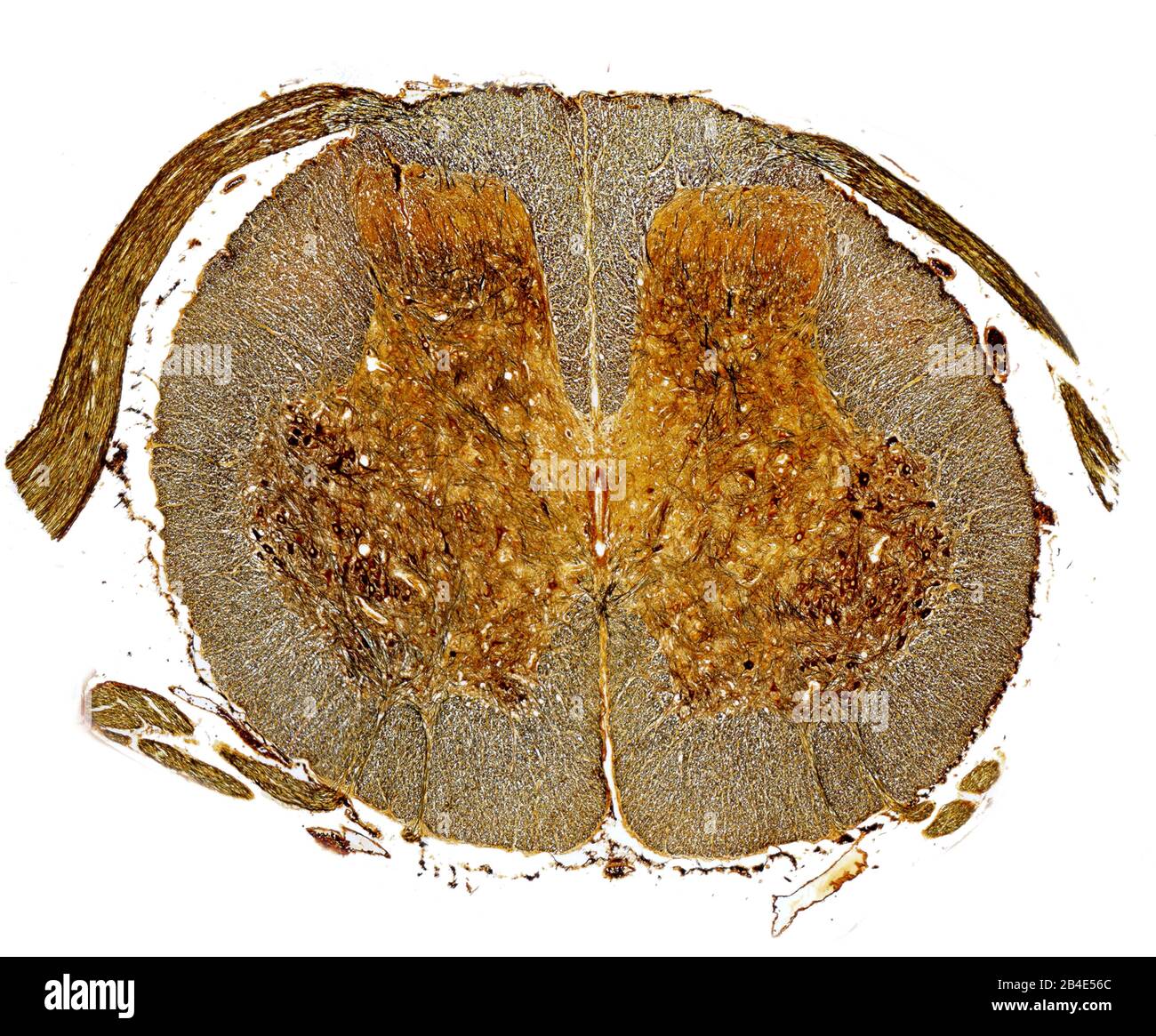 All 32+ Stock Photos the white matter of the spinal cord Latest All 32+ Stock Photos the white matter of the spinal cord Latest