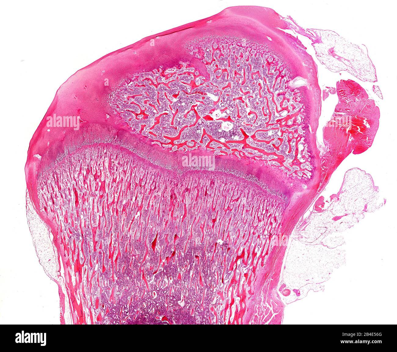 Epiphysis of a developing long bone. A growth plate is located between the primary (down) and secondary (up) ossification centres. Stock Photo