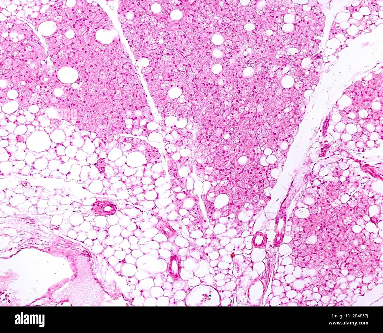 Brown adipose connective tissue