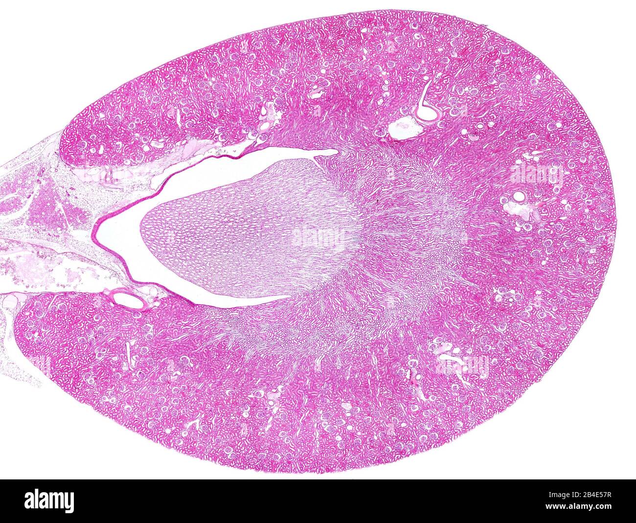 Light micrograph cross section of rat kidney stained with hematoxylin and eosin displaying the peripheral renal cortex (with many glomeruli) and, in t Stock Photo