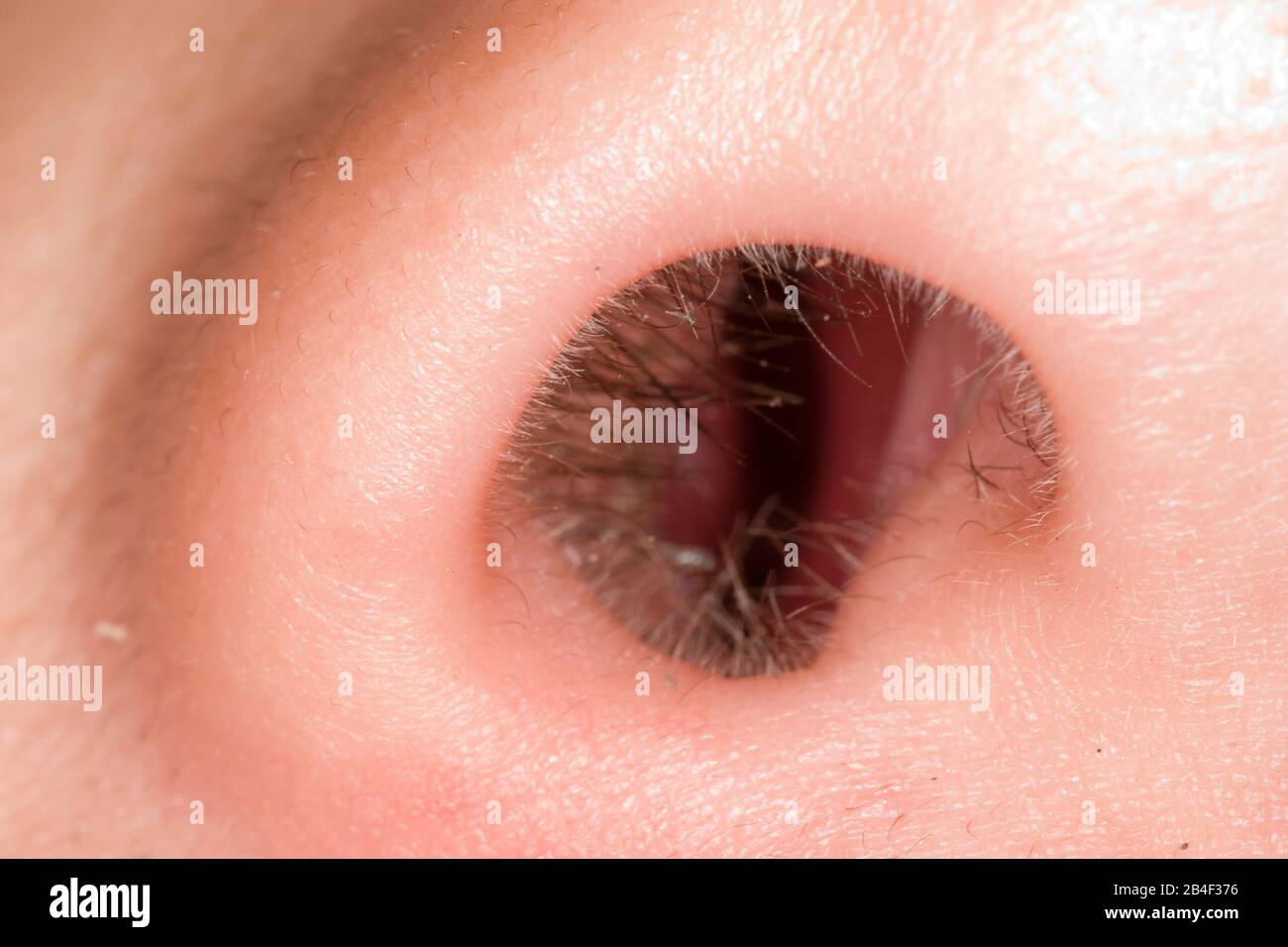 Nasal Mucous Membrane