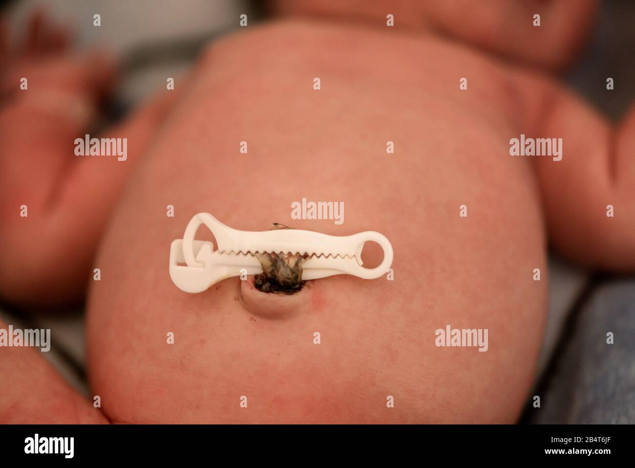 Newborn baby boy laying on the bed with umbilacal cord clamp Stock Photo
