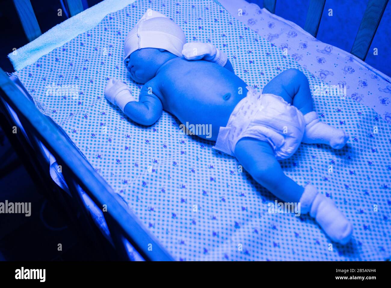 Newborn having a jaundice under ultraviolet light, Baby high level of bilirubin, laying under blue light to reduce jaundice level. S Stock Photo - Alamy