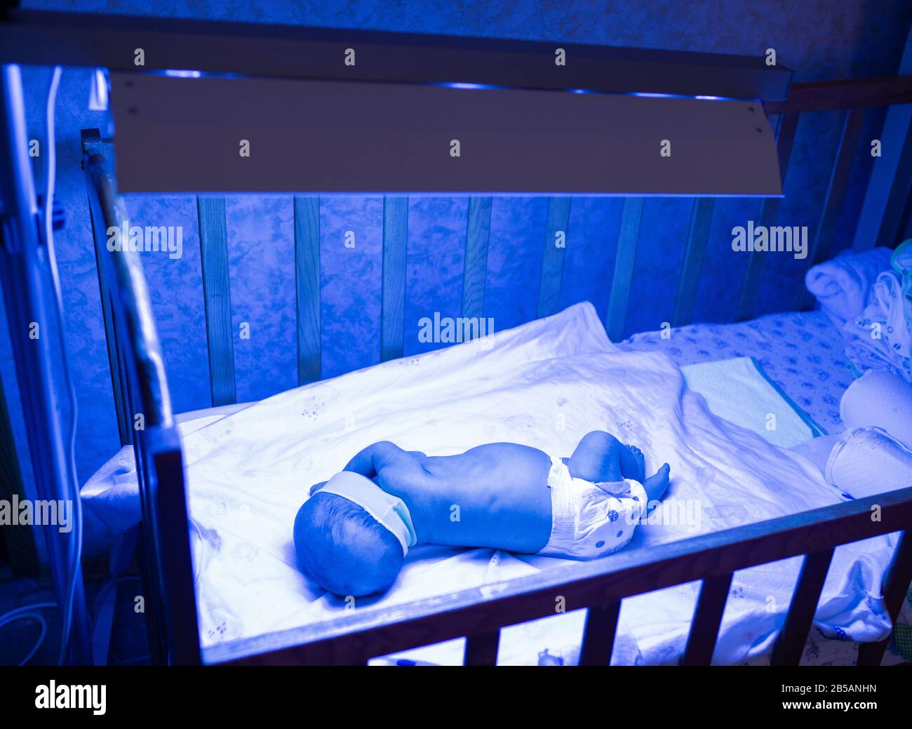 Newborn having a treatment for jaundice under ultraviolet light, Baby