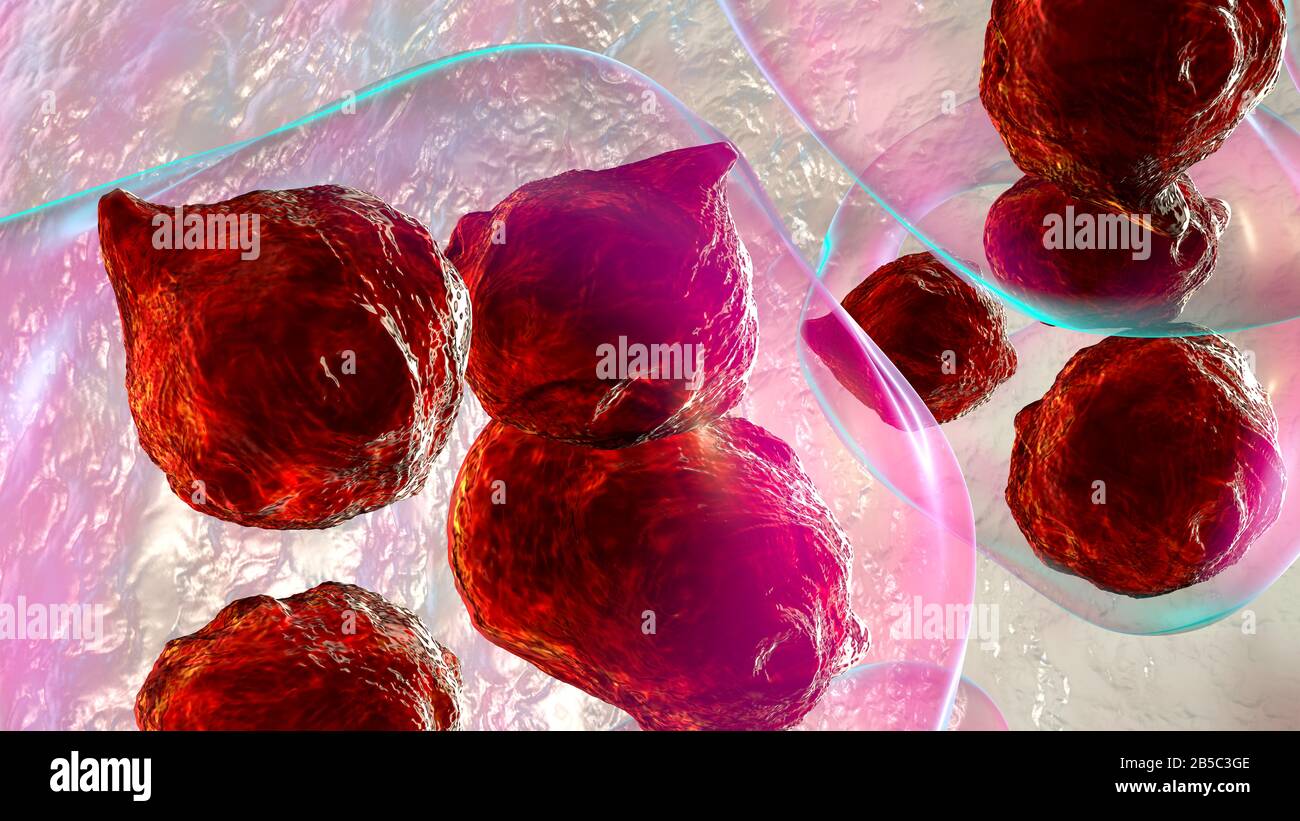 Echinococcus granulosus hydatid cyst, illustration Stock Photo - Alamy