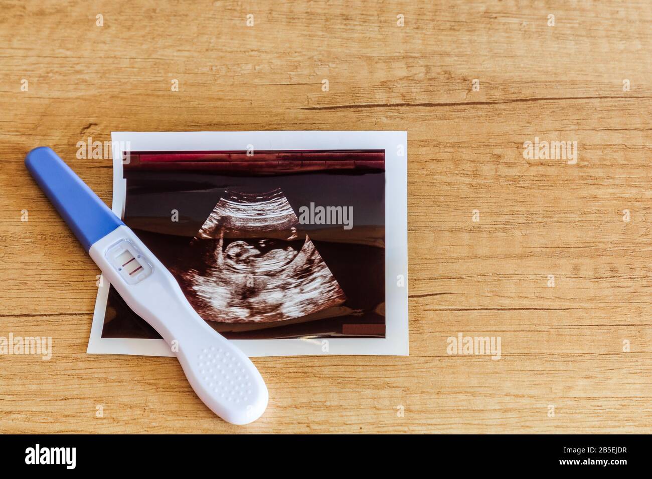 Pregnancy test showing a positive result and ultrasound image isolated on wooden background. Stock Photo