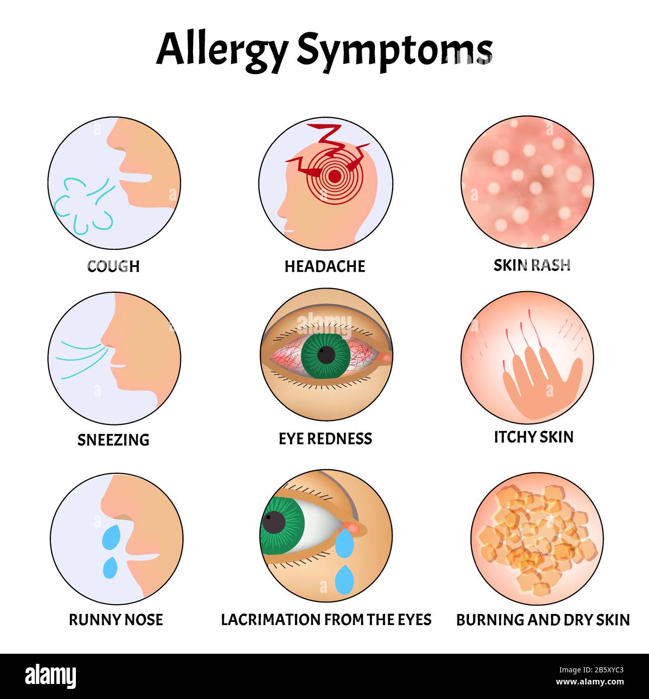 Symptoms of Allergies Skin rash, Allergic skin itching, Tearing from the  eyes, Cough, Sneezing, Runny nose, Headache, Redness of the eyes Stock  Vector Image & Art - Alamy