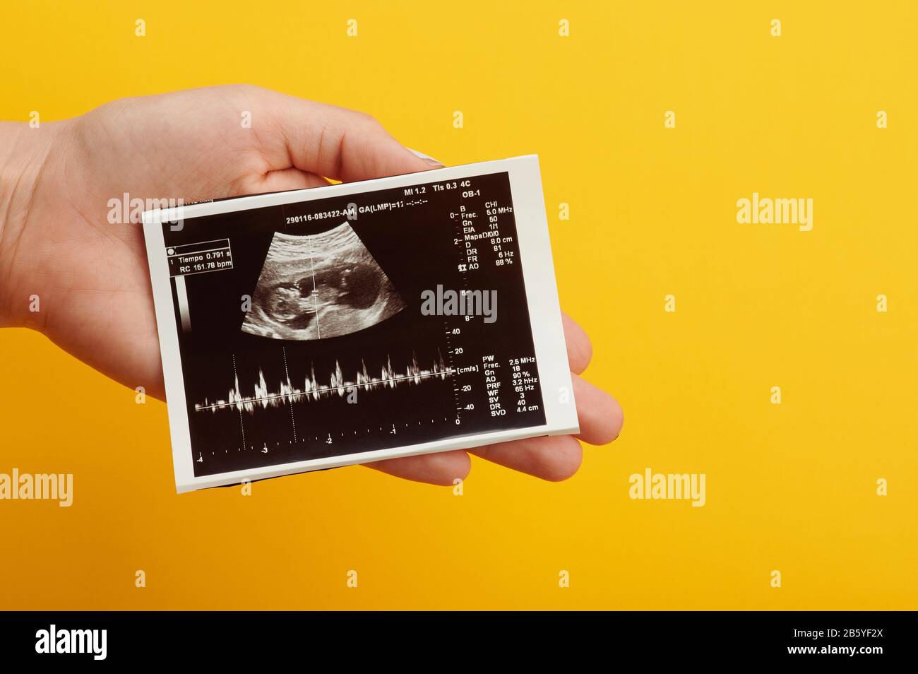 Ultrasound photo of future baby in woman hand close up view Stock Photo