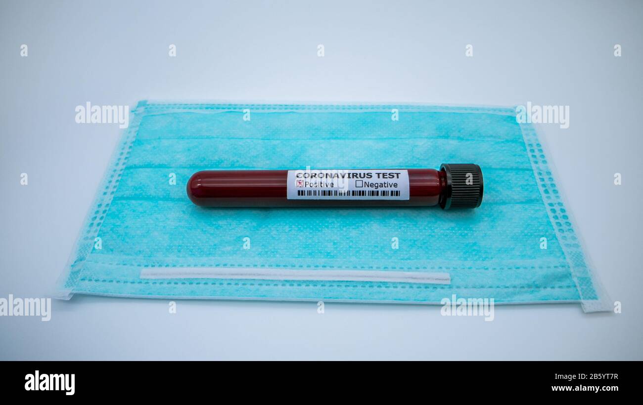 38+ Covid 19 Positive Test Report Sample Gif