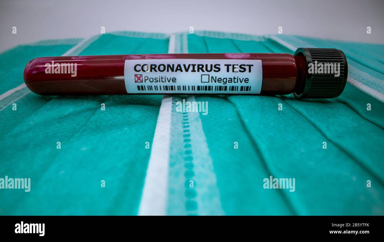 Protective mask and positive COVID19 test. Laboratory sample of blood