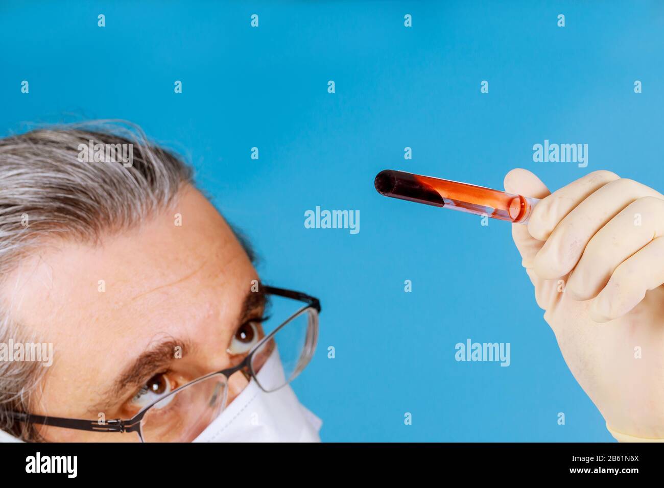 Laboratory technician vacuum test tube blood for testing in laboratory