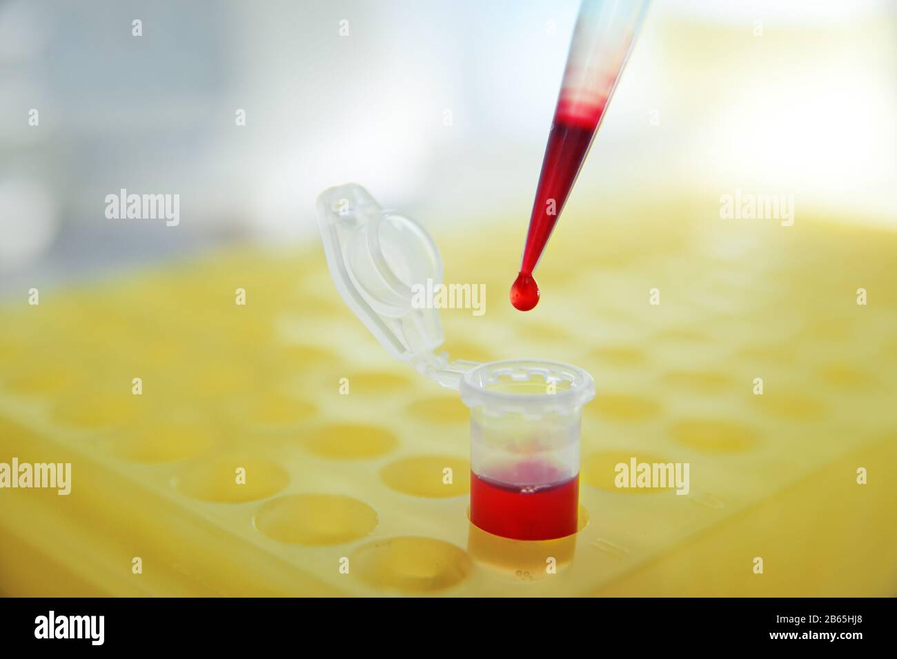 drop of blood closeup at the end of a medical pipette or dispenser in