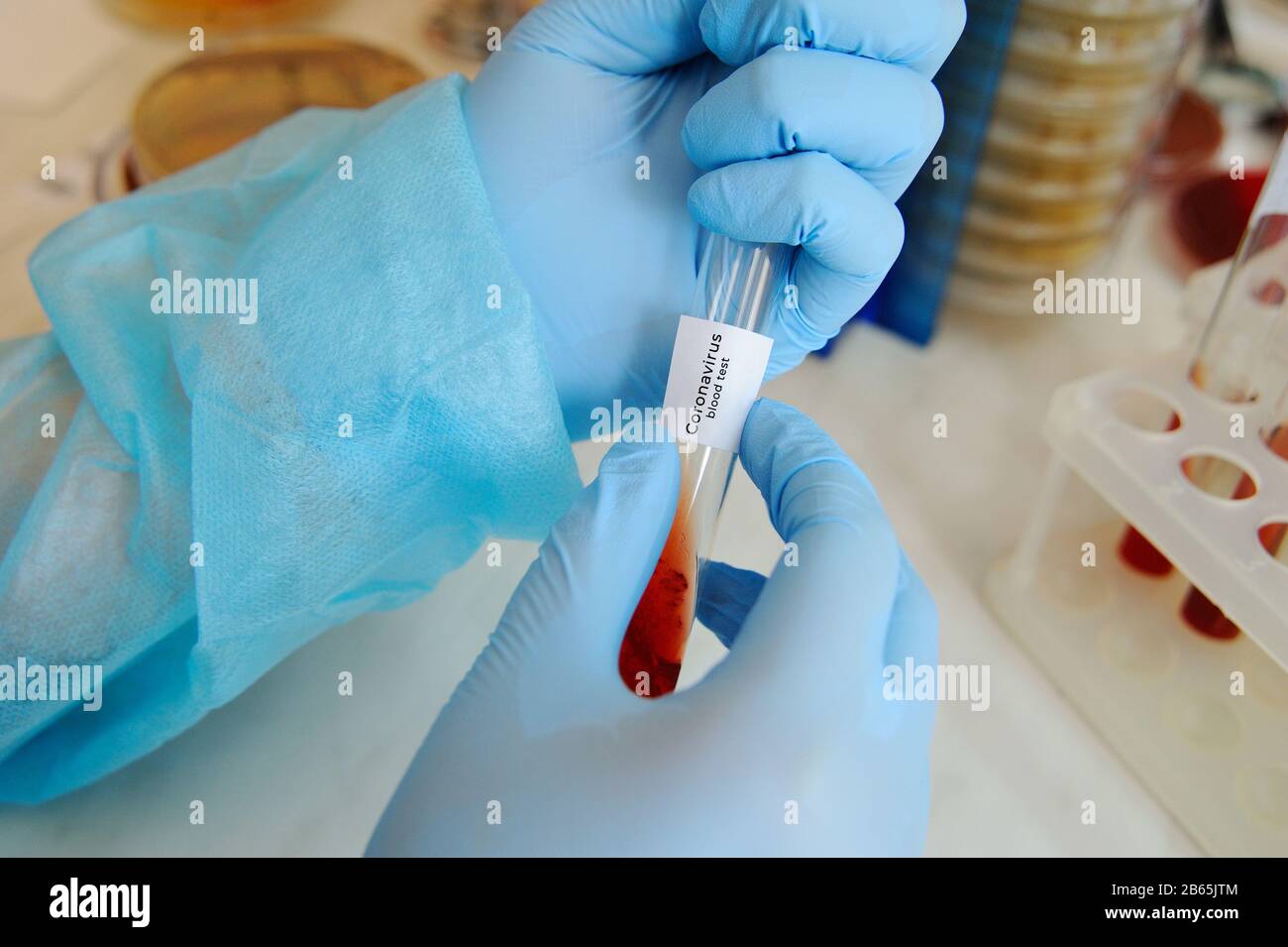 a glass test tube or a flask with blood Stock Photo - Alamy