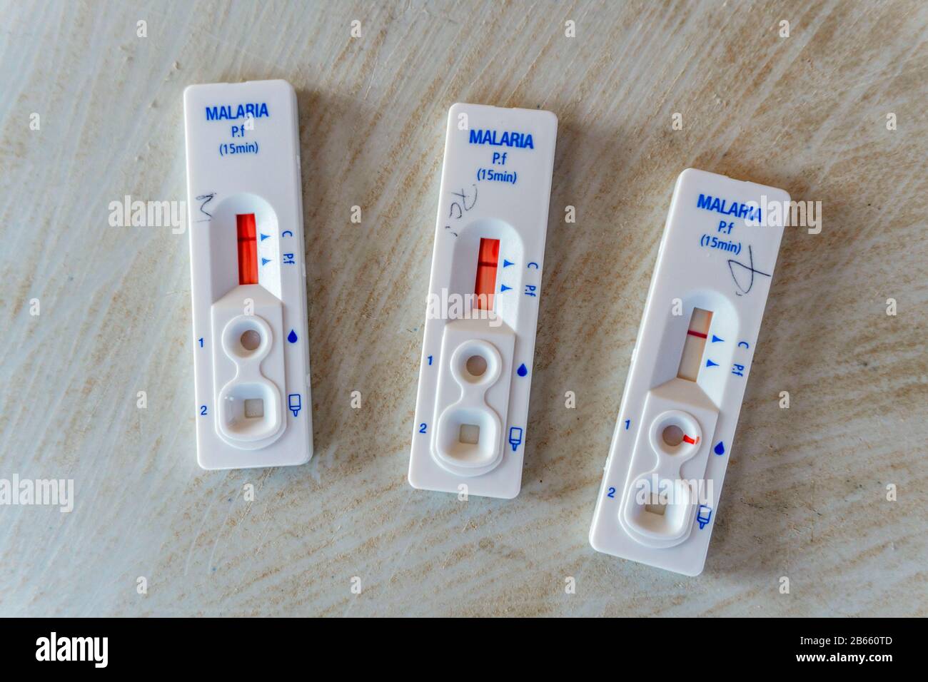 Results of quick malaria test from blood, Lebombo Border Control, South Africa Stock Photo
