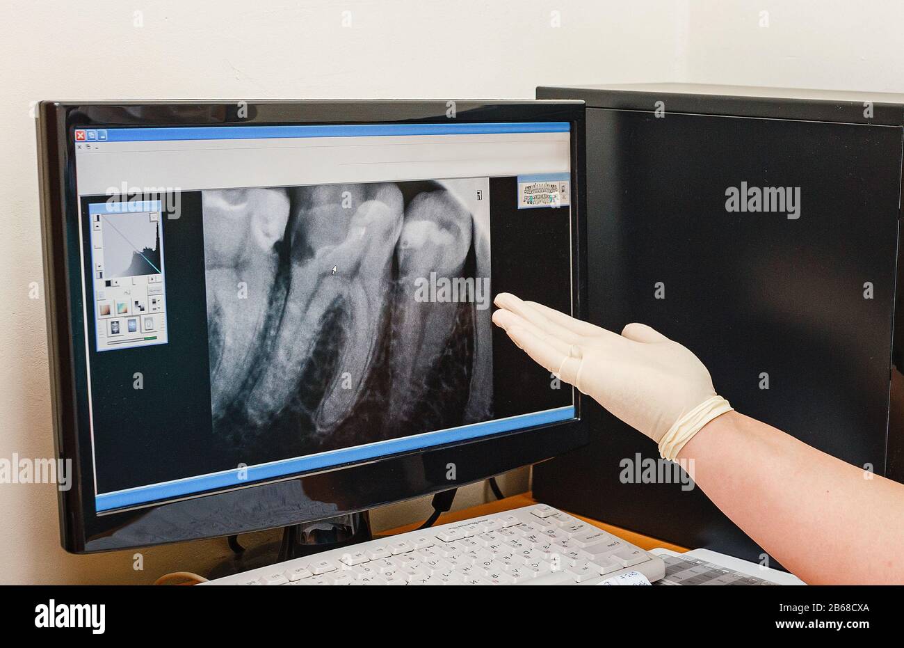Hospital x ray room monitor screen hi-res stock photography and images ...