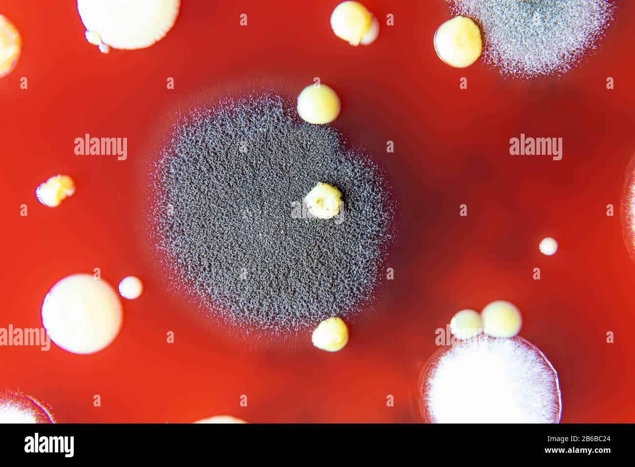 Mixed of bacteria colonies in Petri dish Stock Photo