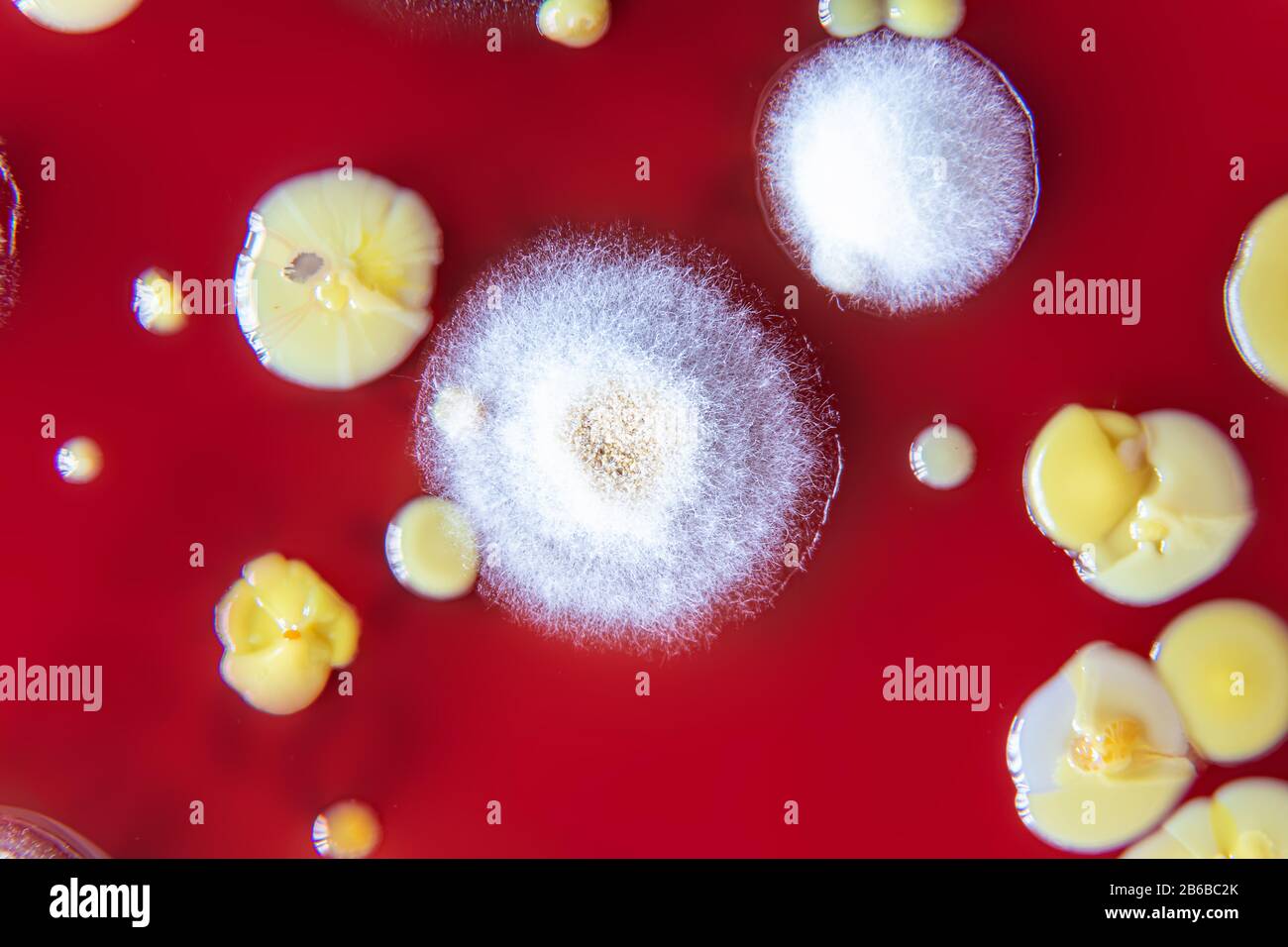 Mixed of bacteria colonies in Petri dish Stock Photo