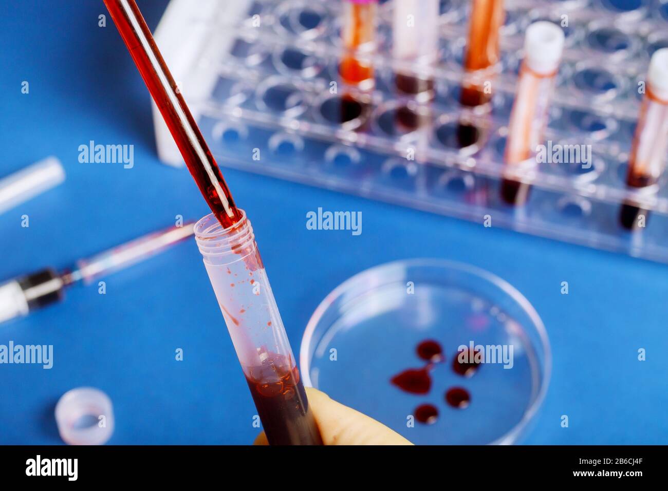 Hand holding blood sample vial in laboratory tube test Stock Photo Alamy