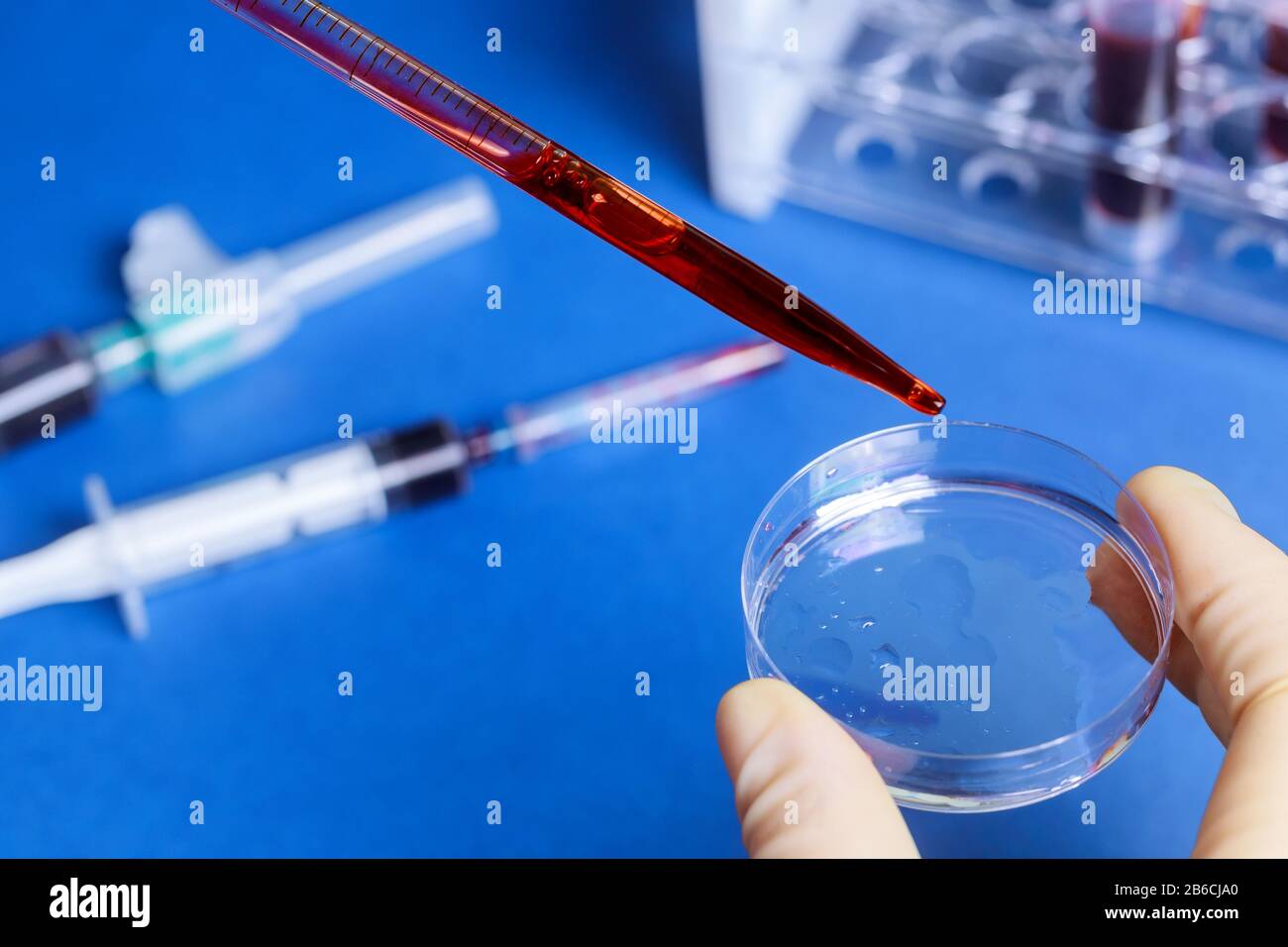 Blood sample with pipette and petri dish others blood test tubes in a rack exam test analysis hospital Stock Photo