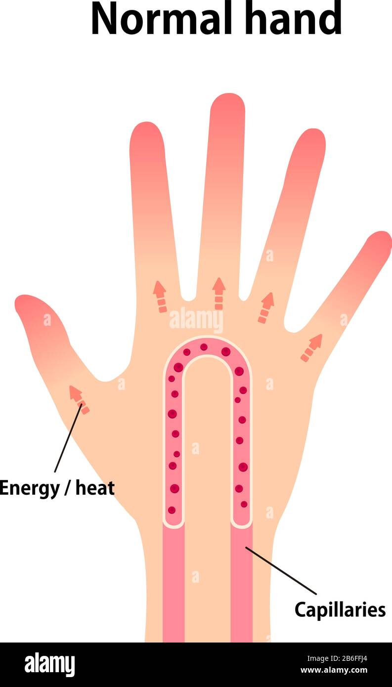 Poor Circulation Hot Hands Best Sale Dakora co poor-circulation-hot-hands-best-sale-dakora-co