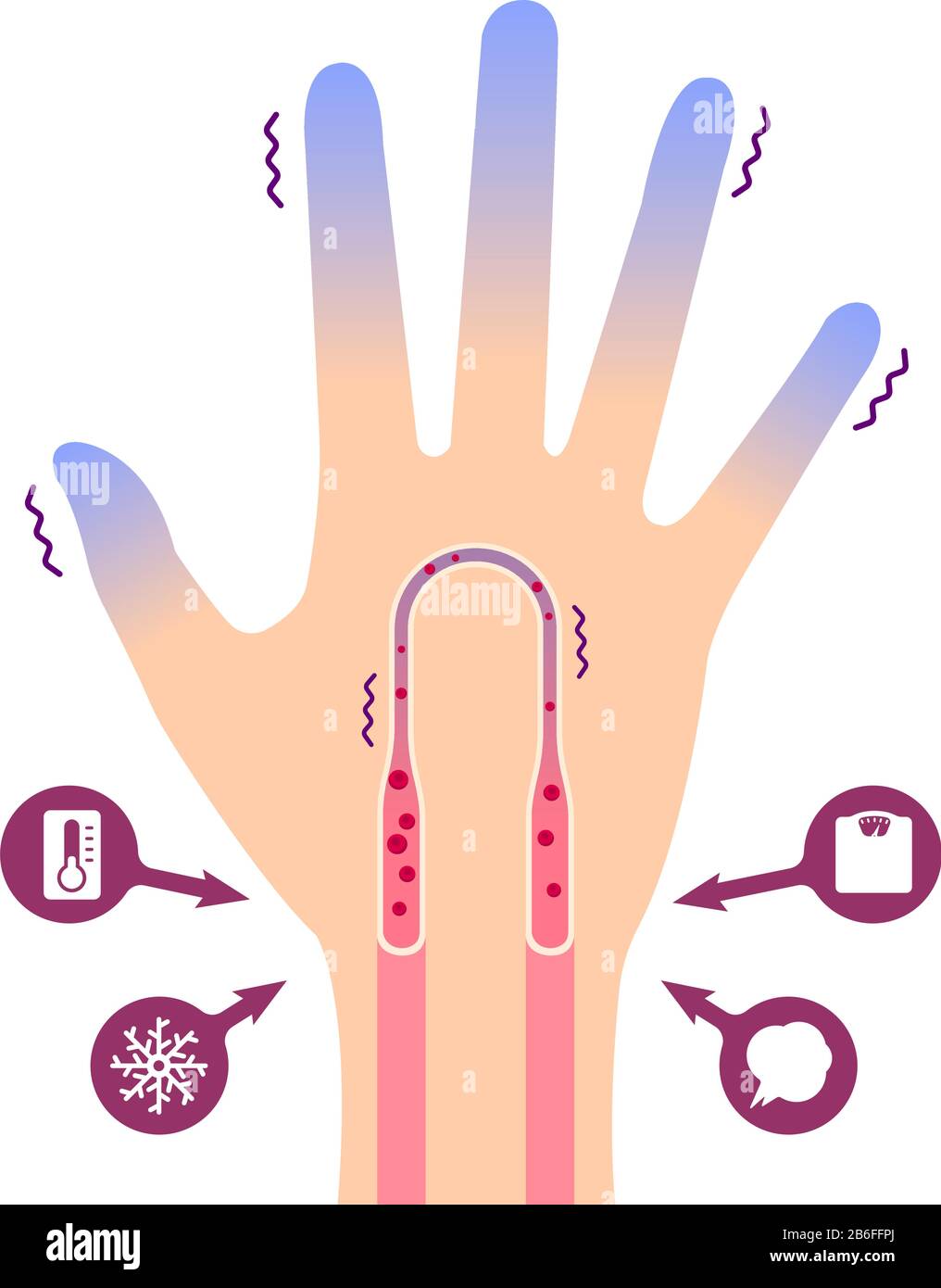 Cold hand blood circulation illustration (sensitivity to cold, cold