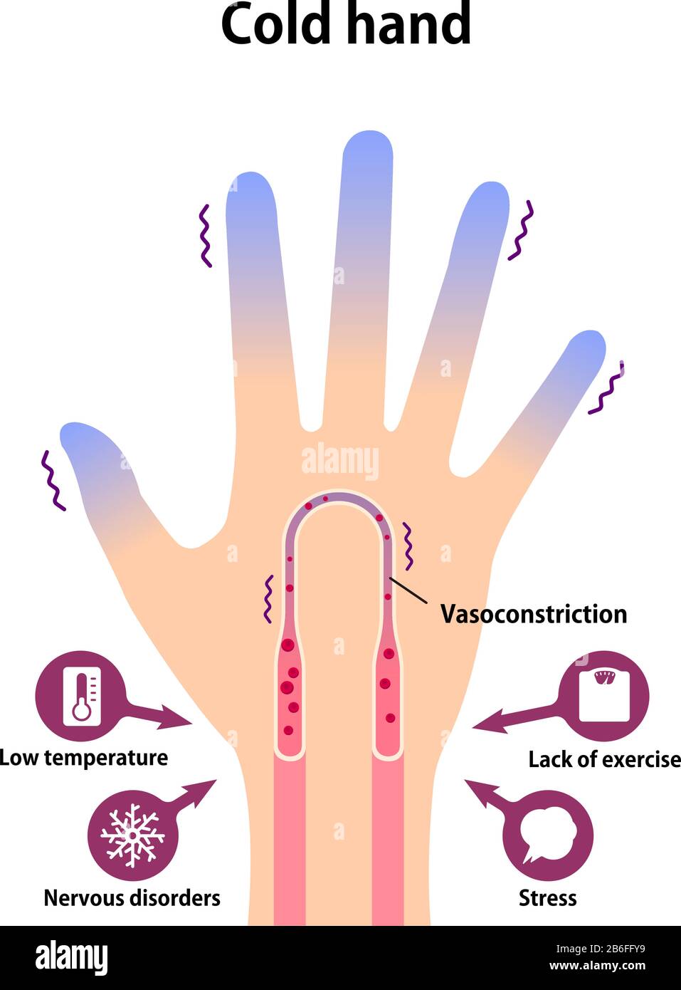 Cold hand blood circulation illustration sensitivity to cold cold fingertips Stock Vector Image Art Alamy