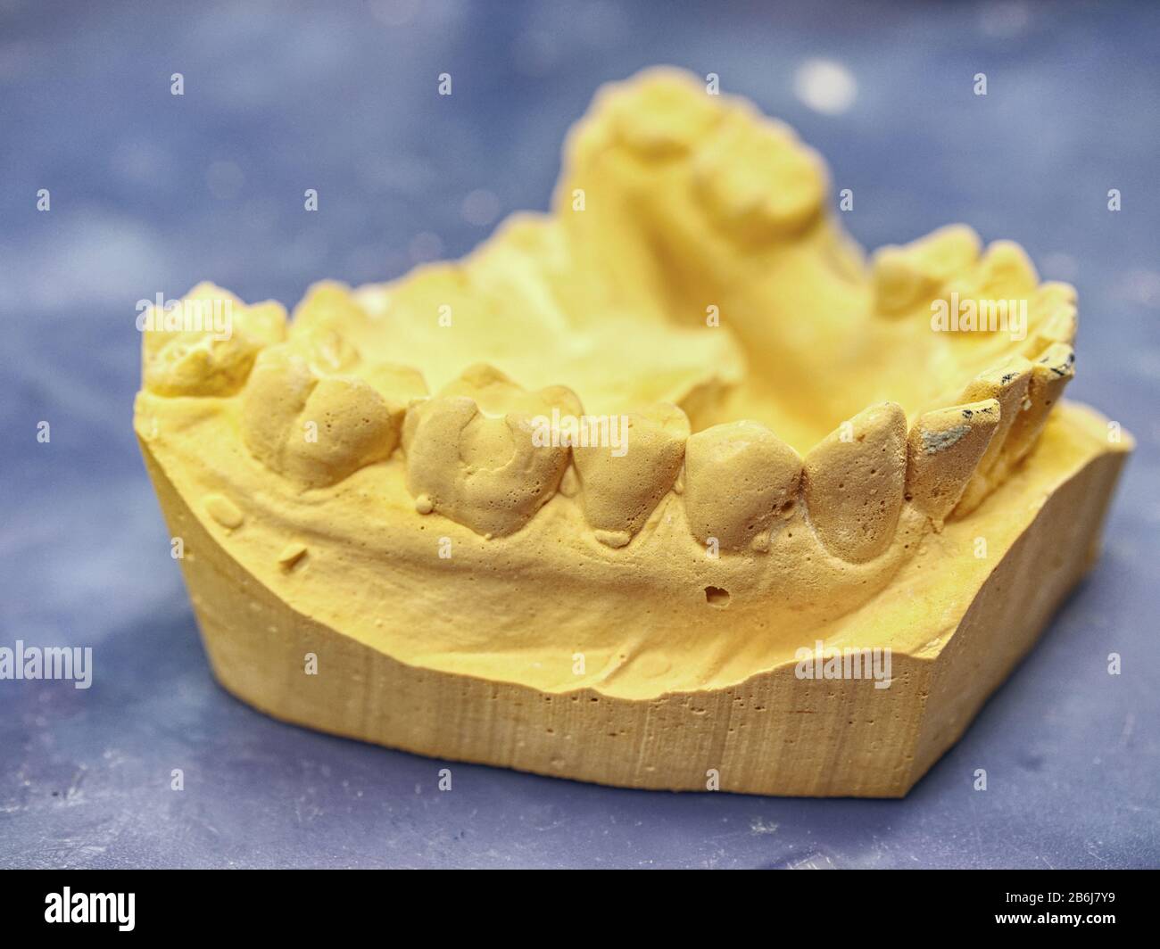 Teeth gypsum model. Dental care concept. Human teeth with dentures on