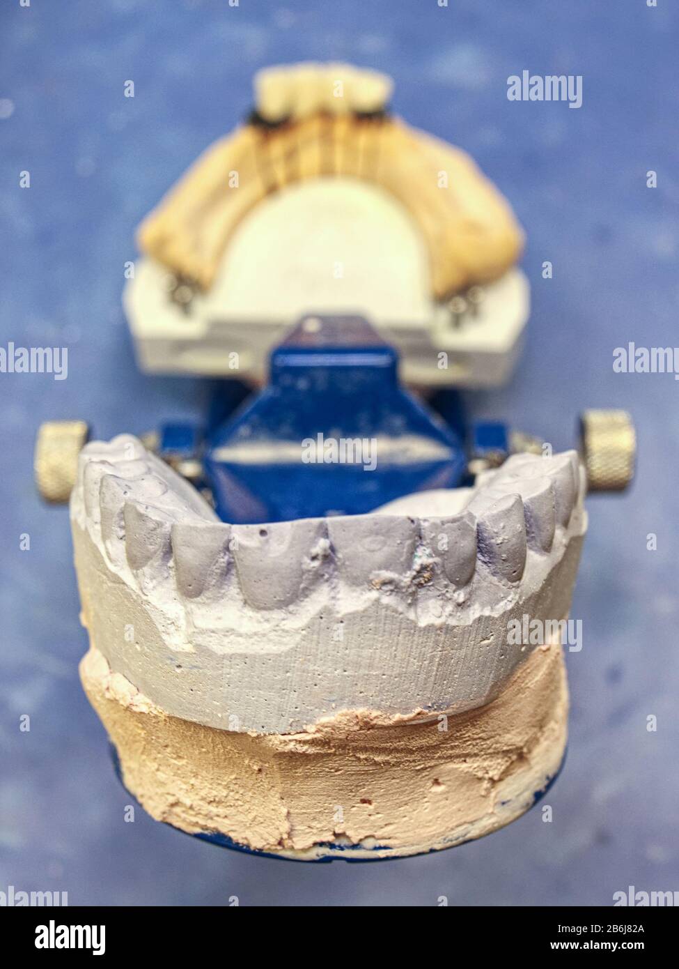 Dental articulator with gypsum cast on the working table in the dental