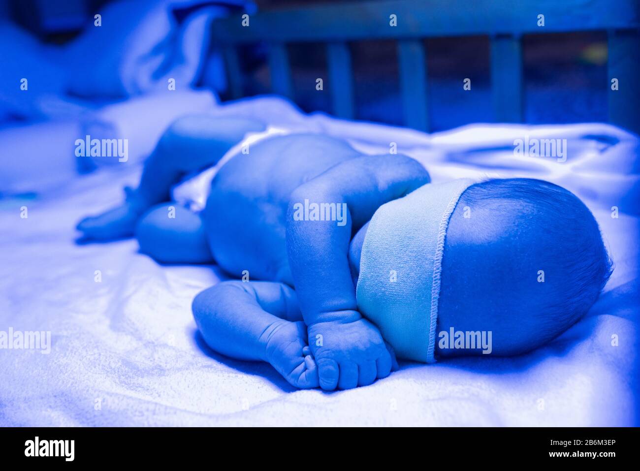 Newborn having a treatment for jaundice under ultraviolet light, Baby