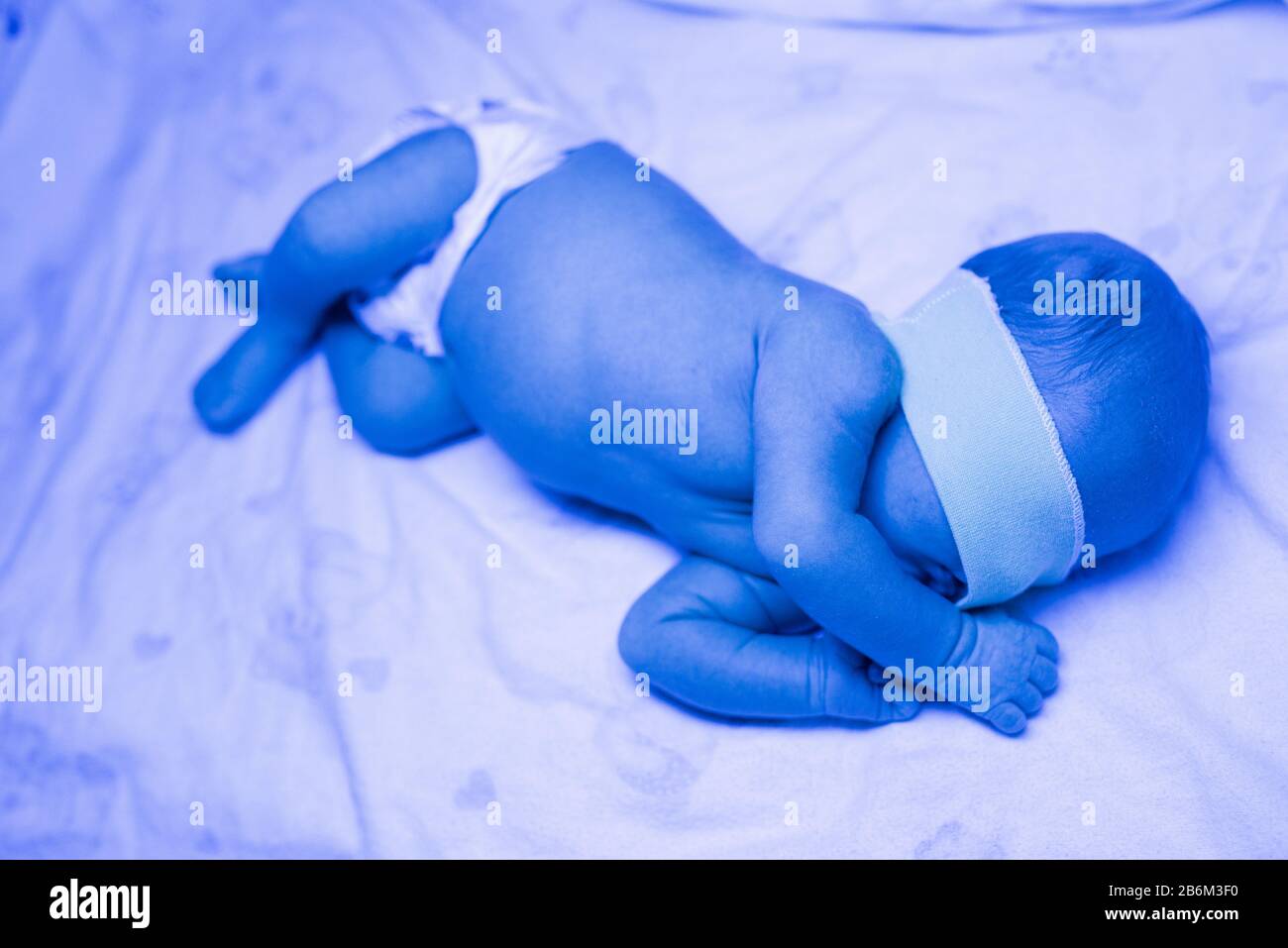 Newborn having a treatment for jaundice under ultraviolet light, Baby