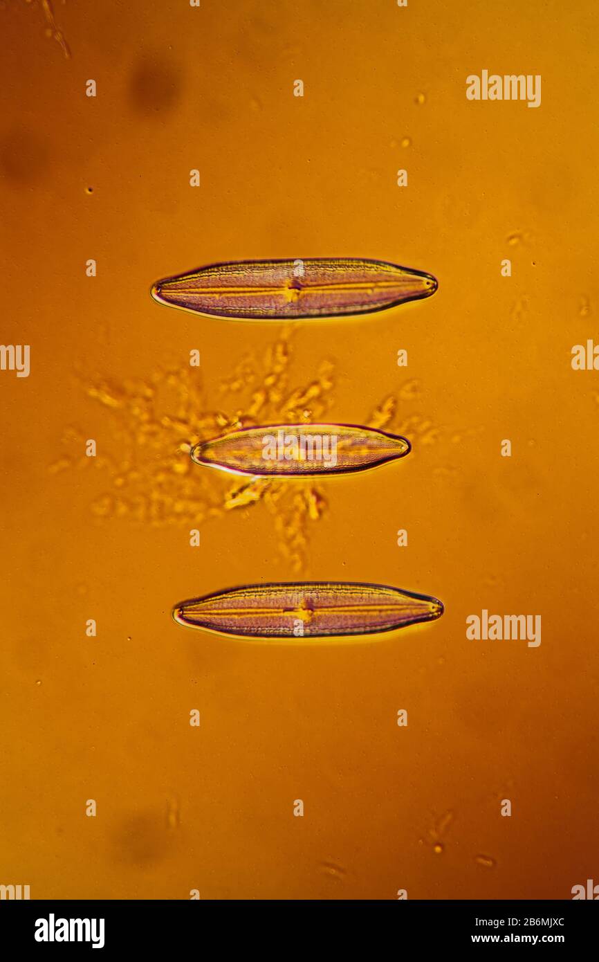 tiny microscopic diatoms in drops of water Stock Photo