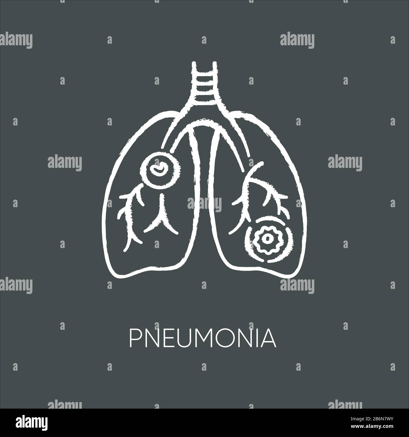 Pneumonia chalk white icon on black background. Dangerous respiratory disease, pulmonary illness. Streptococcus infection, mycoplasma bacteria Stock Vector