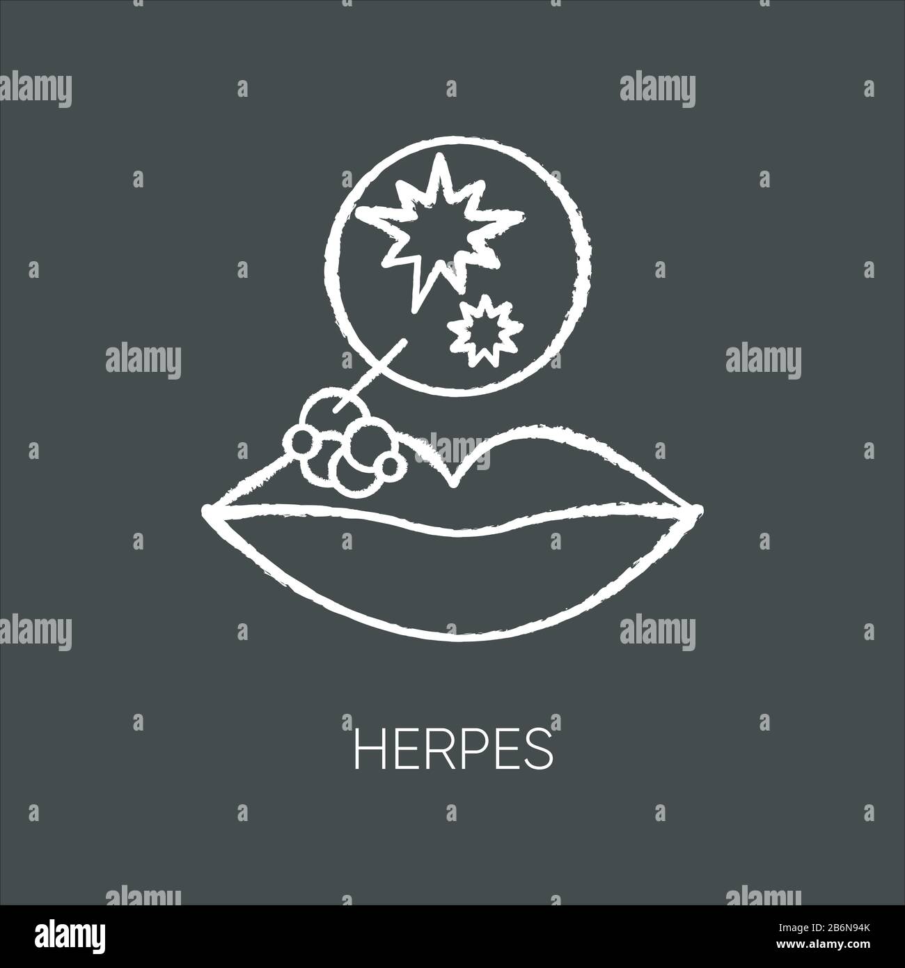 Herpes chalk white icon on black background. Viral skin infection, contagious STD, sexually transmitted disease. Lips with swollen blisters, rash Stock Vector