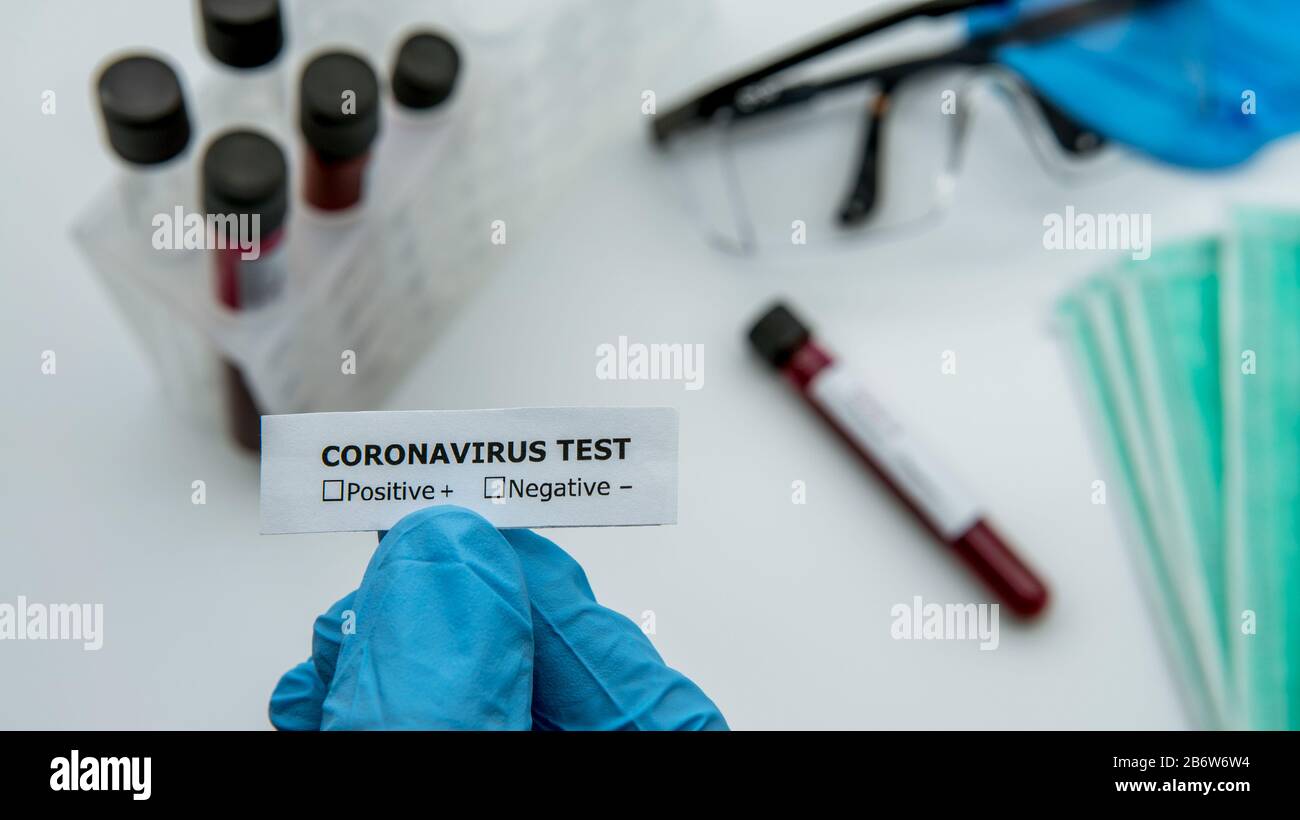 Scientist with blue gloves hold the identifier sticker for blood sample tube for corona virus test, COVID-19. The virus has caused emergency situation Stock Photo