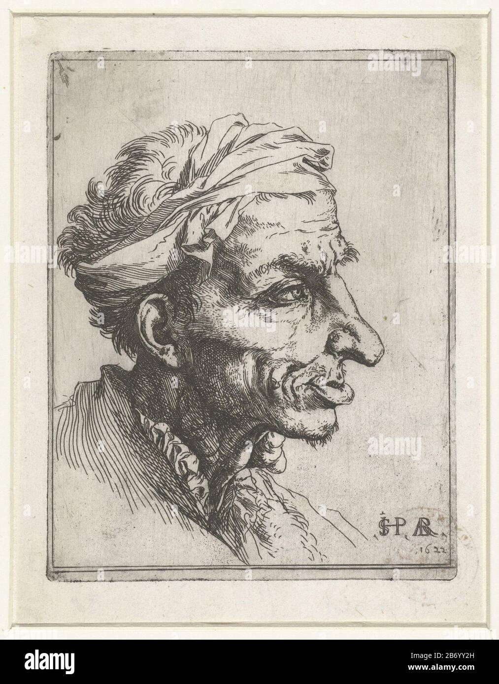 Klein grotesk hoofd Head of an Old man with a band around his head, in profile. In his neck a gezwel. Manufacturer : printmaker: Jusepe de Ribera (listed building) in its design: Jusepe de RiberaPlaats manufacture: Naples Date: 1622 Physical features: etching material: paper Technique: etching Dimensions: plate edge: H 145 mm × W 112 mmToelichtingDe man in his neck tumor, a sign of the disease Von Recklinghausen (Neurofibromatosis) . Subject: disabilities, deformationsdiseases Affecting parts of the body and right Stock Photo