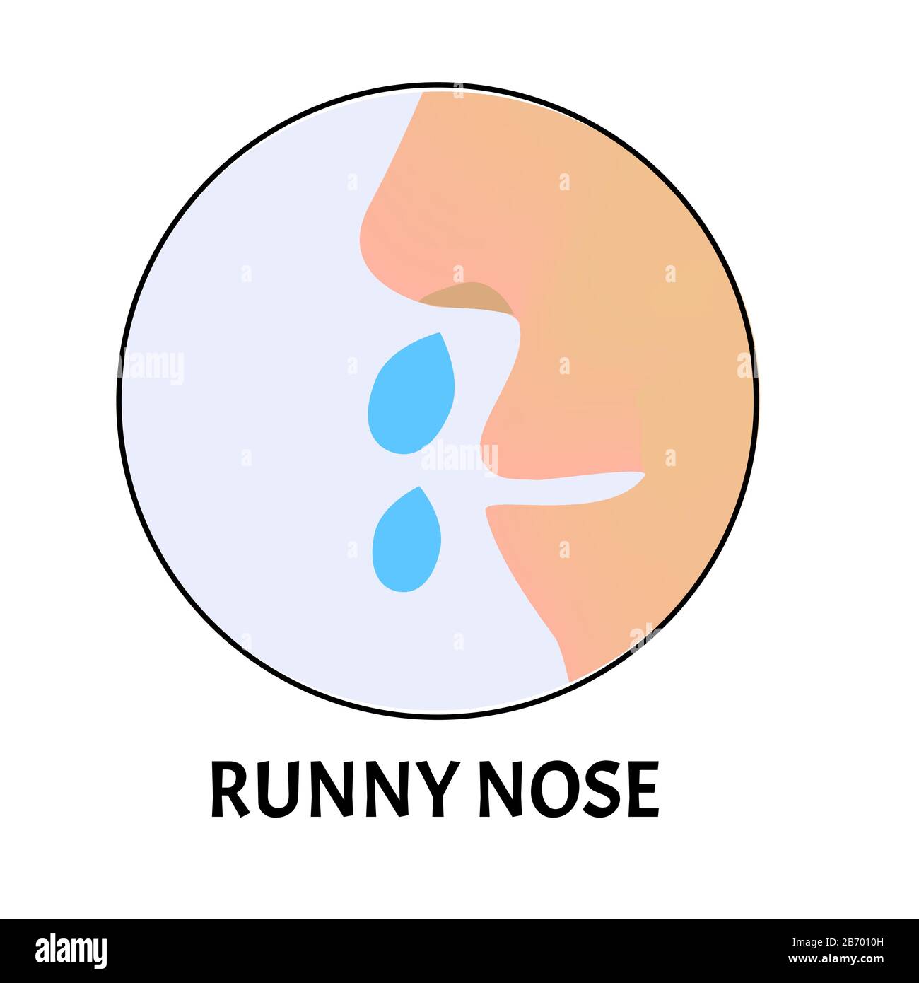 Runny nose. Symptom of influenza, allergies, bronchitis, pneumonia