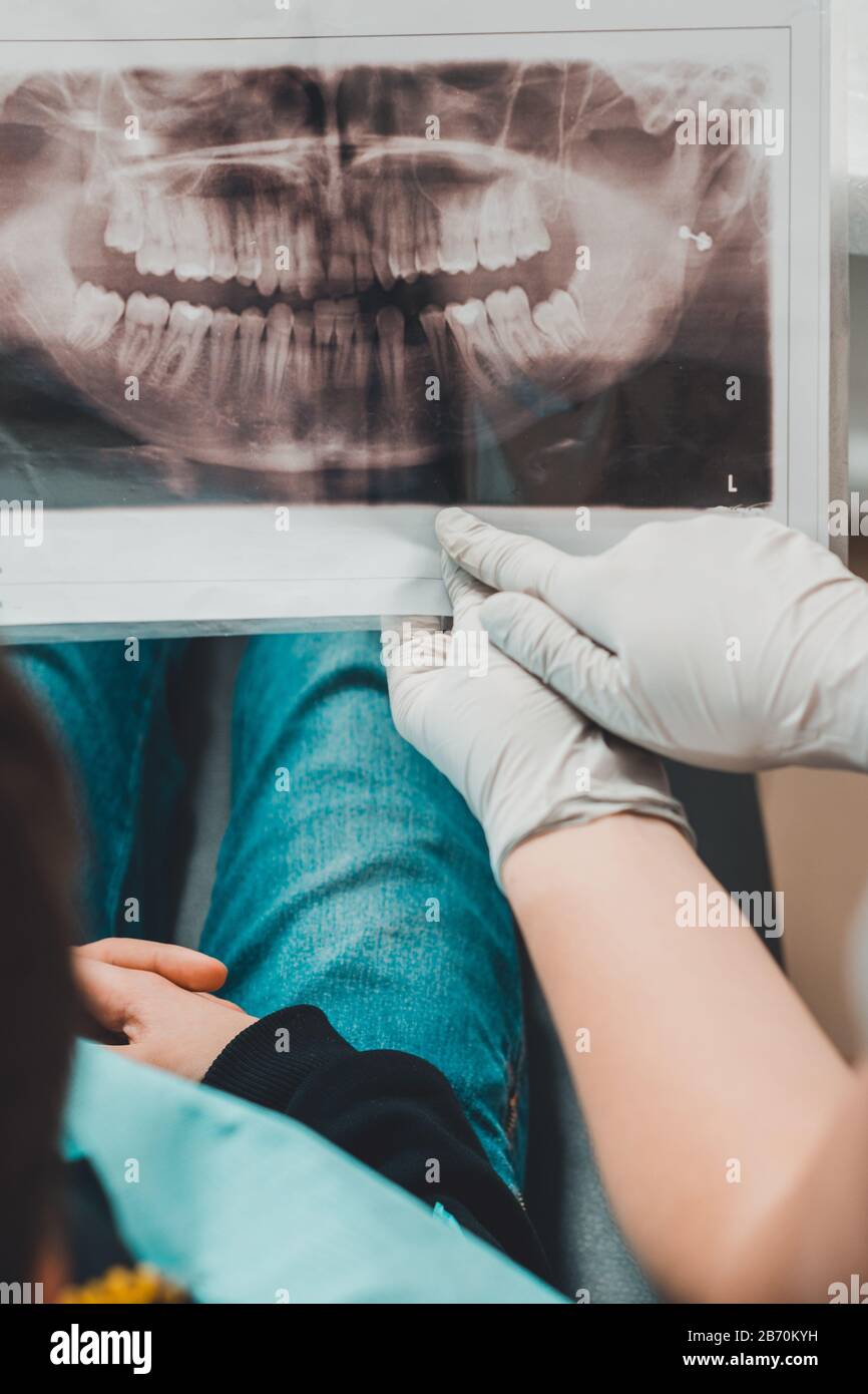 An orthodontist doctor shows the boy an xray of his teeth. OPG, 3D
