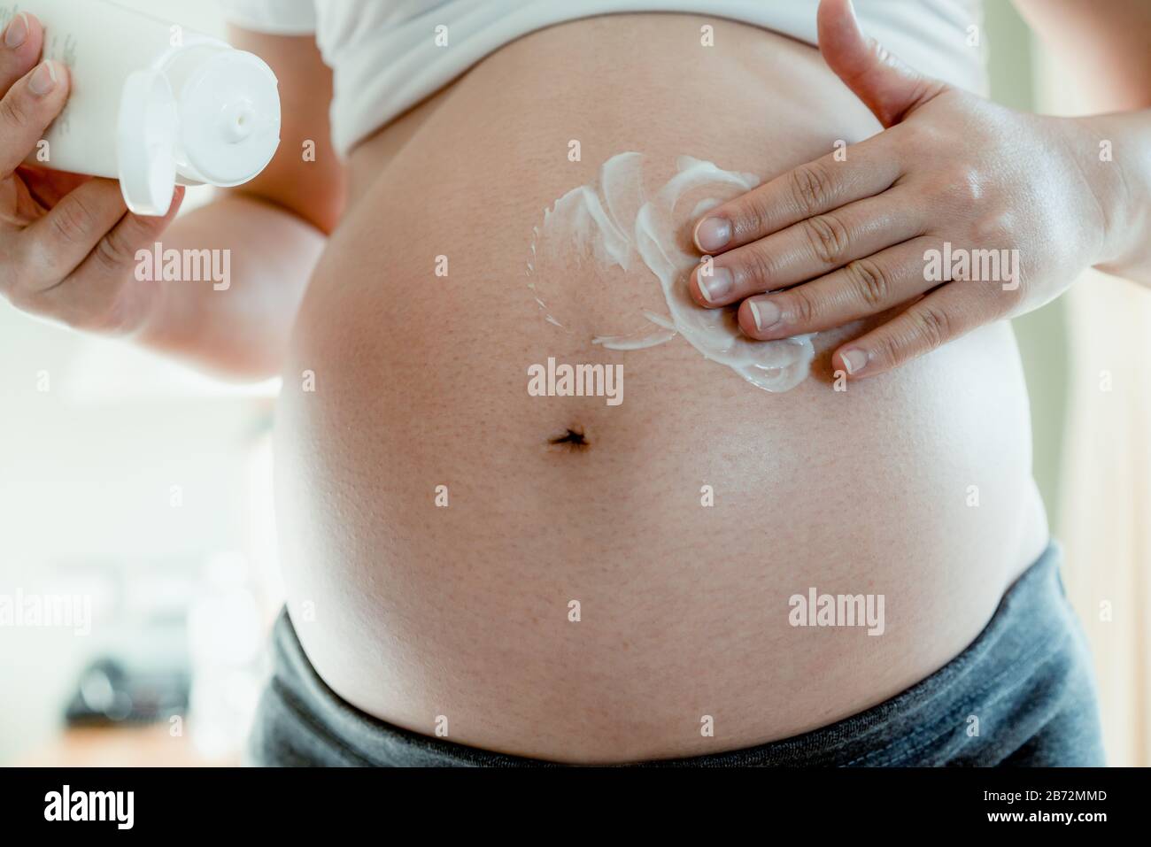 Happy Pregnant Woman Apply Skincare Cream Lotion On Pregnant Belly To Prevent Stretch Mark 