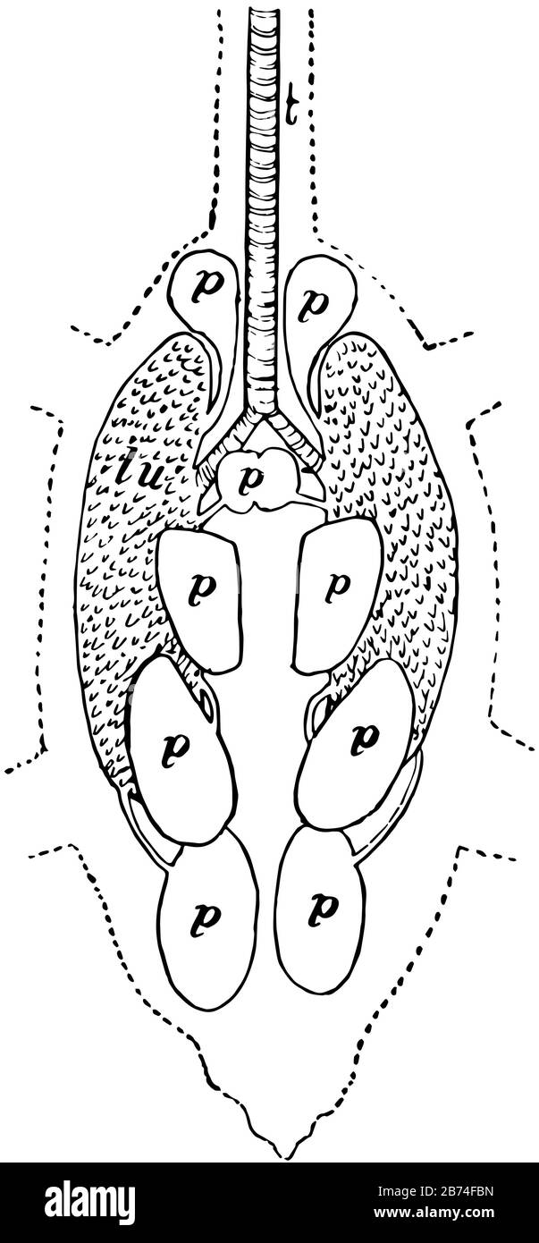 Pigeon Lungs is a subset of hypersensitivity pneumonitis, vintage line
